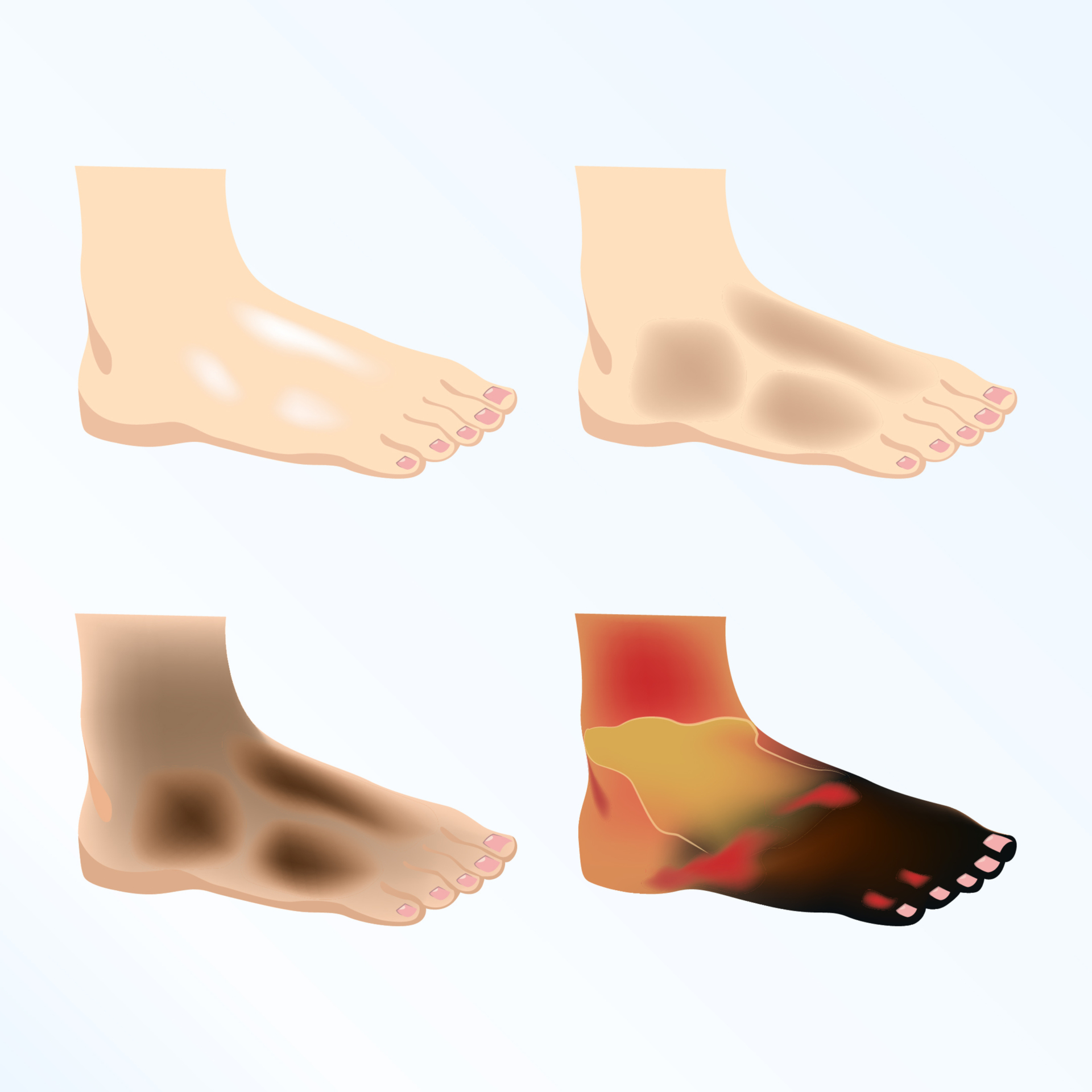 Brennen In Den Beinen Im Ruhezustand www.biomag-magnetfeldtherapie.de